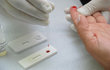 Governo federal raciona exame de carga viral para HIV